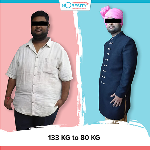 Before And After Image after Weight Loss Surgery
