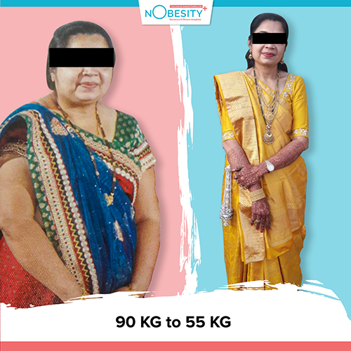 Nobesity Weight Loss Clinic In Ahmedabad