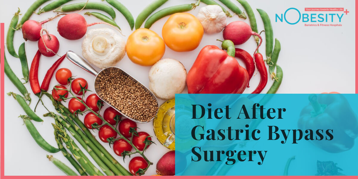 crafting-a-healthy-diet-plan-post-gastric-bypass-surgery