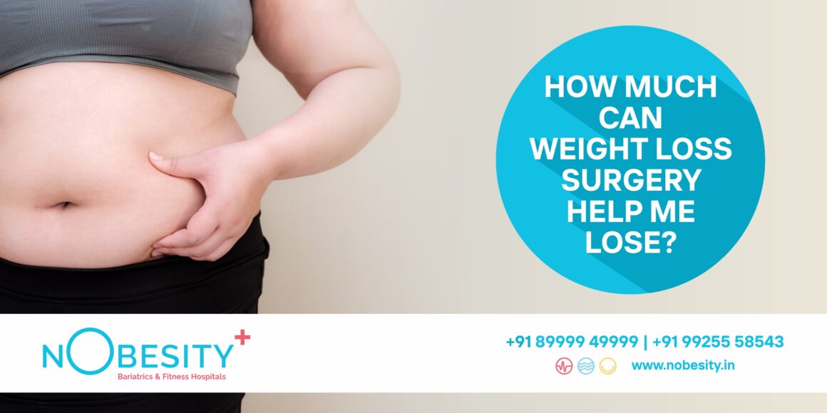 How Much Can Weight Loss Surgery Truly Affect You!