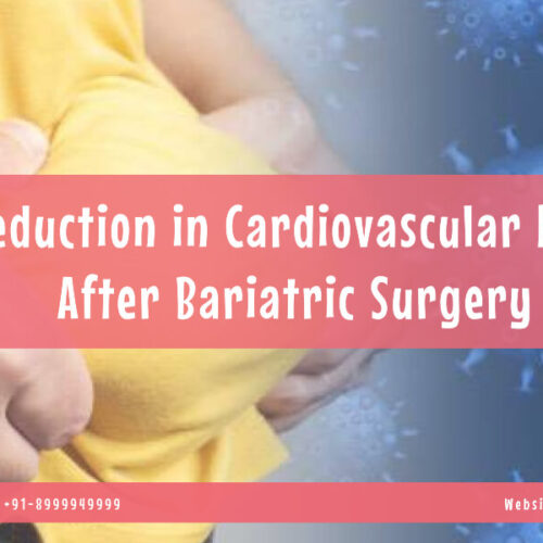 Reduction in Cardiovascular Risk After Bariatric Surgery