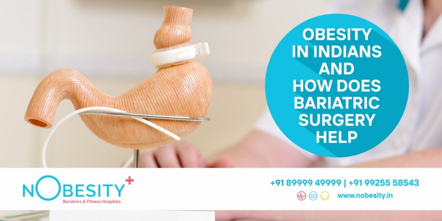 Obesity In Indians and How does Bariatric Surgery Help?