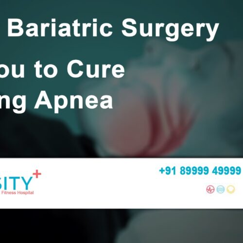 How Baritric Surgery Helps You to Cure Sleep Apnoea?
