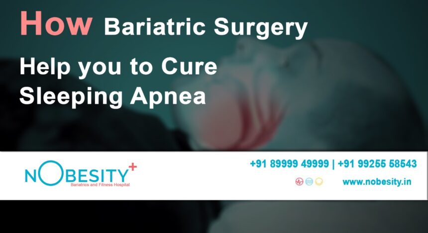 How Bariatric Surgery Helps You to Cure Sleep Apnoea?