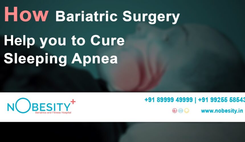 How Bariatric Surgery Helps You to Cure Sleep Apnoea?