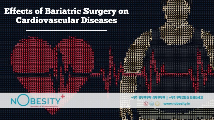 Effects of Bariatric Surgery on Cardiovascular Diseases