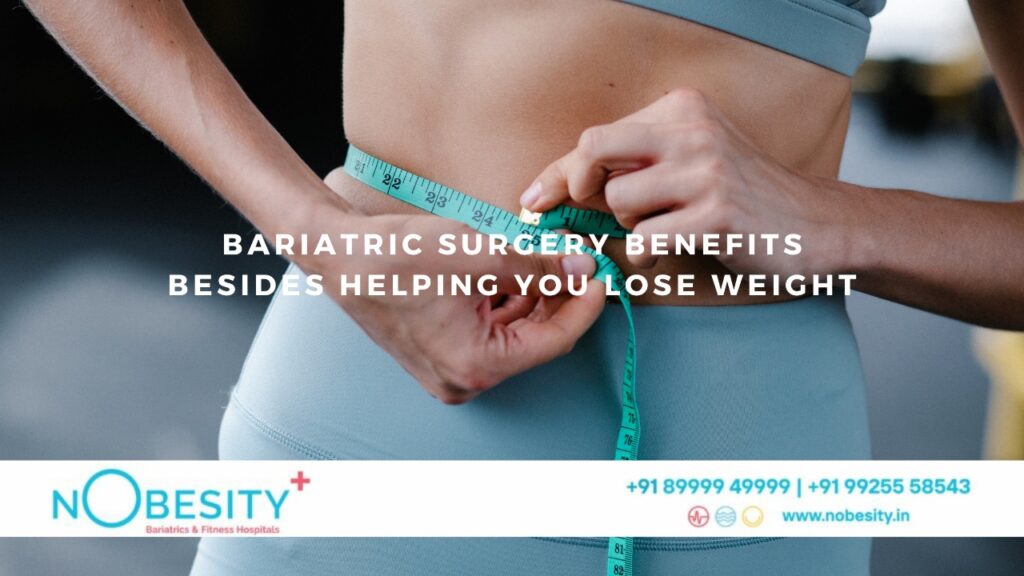 Bariatric Surgery Benefits You Besides Helping You Lose Weight