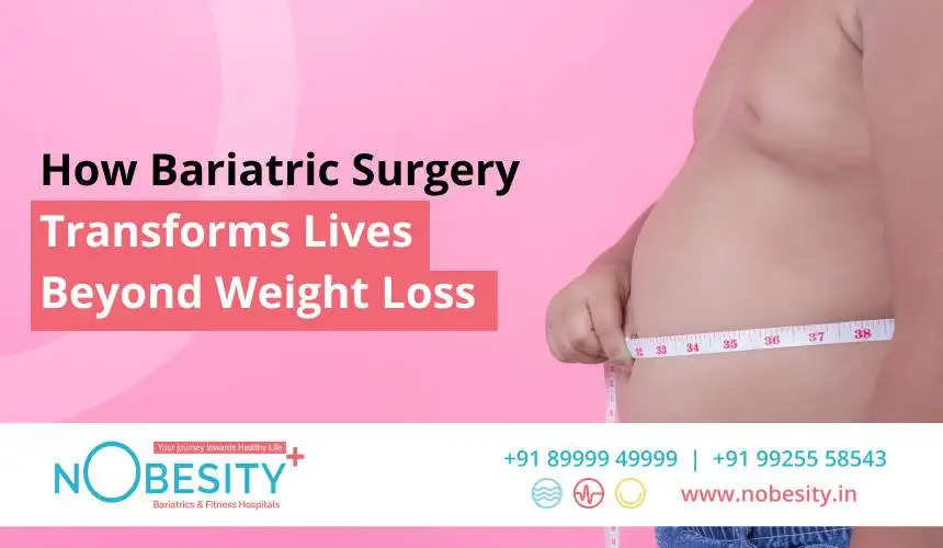 How Bariatric Surgery Transforms Lives Beyond Weight Loss