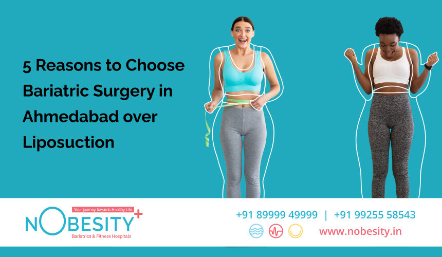 5 Reasons to Choose Bariatric Surgery in Ahmedabad over Liposuction