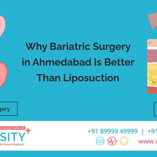 Why Bariatric Surgery in Ahmedabad Is Better Than Liposuction