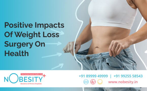 Positive Impacts Of Weight Loss Surgery On Health – NObesity