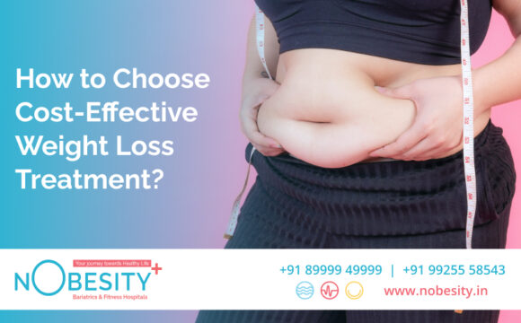 How to Choose Cost-Effective Weight Loss Treatment?