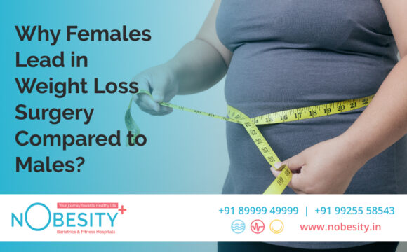 Why Females Lead In Weight Loss Surgery Compared To Males?