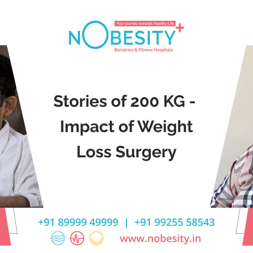Stories of 200 KG –  Impact of Weight Loss Surgery