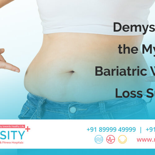 Demystifying the Myths of Bariatric Weight Loss Surgery