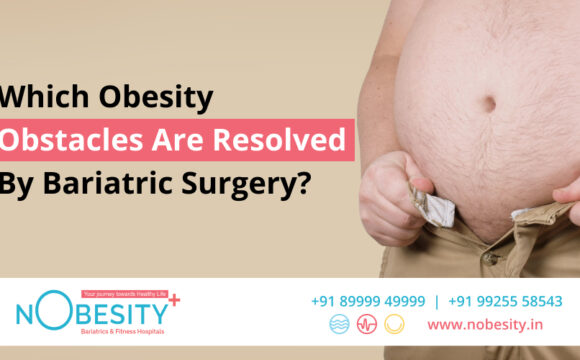 Which Obesity Obstacles Are Resolved By Bariatric Surgery?