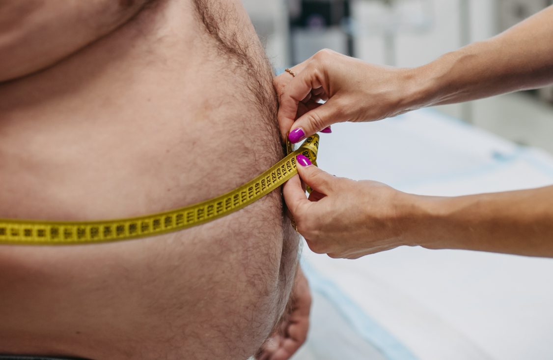Image Of A Fat Man Getting Checked For Is he eligible for bariatric weight loss surgery