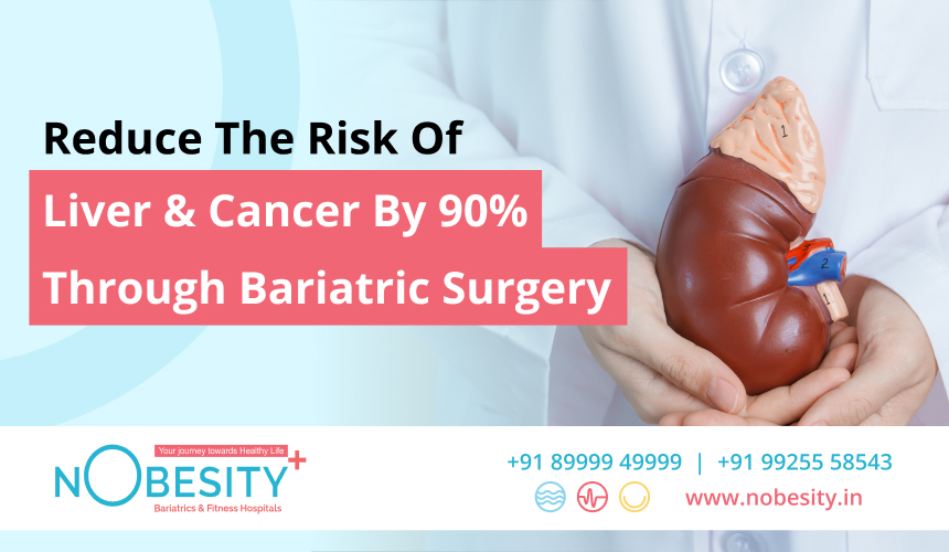 Reduce The Risk Of Liver & Cancer By 90% Through Bariatric Surgery