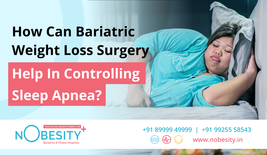 How Can Bariatric Weight Loss Surgery Help In Controlling Sleep Apnea?