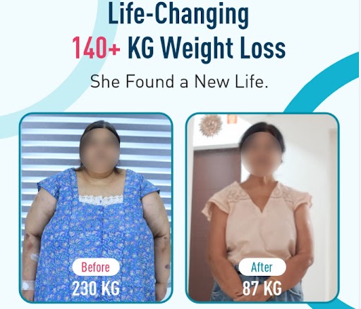 Weight Loss Journey