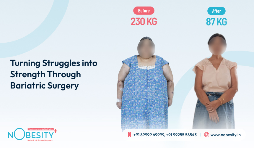 From 230 Kg to 87 Kg: How Bariatric Surgery Gave Mrs. Khatri a New Beginning