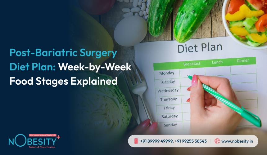 Post-Bariatric Surgery Diet Plan: Week-by-Week Food Stages Explained